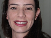 Palestra sobre Trombose