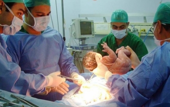 Nova Regra: Parto Cesáreo