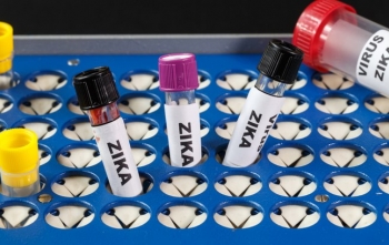 Exames para detecção do Zika