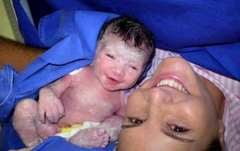 Parto Natural X Cesáreo