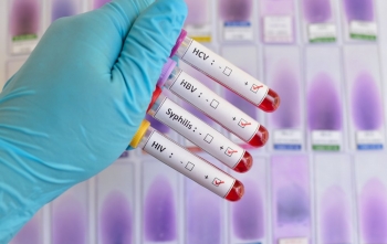 8 DSTs comuns e seus efeitos na gravidez