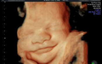 Tecnologia e Ultrassonografia